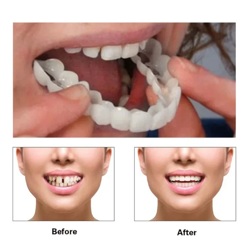 Quick Makeup Teeth Veneers, In - Beauty Makeup Look บทวิจารณ์และราคา